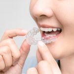 asian woman holding an invisalign braces or invisible retainer, orthodontic equipment, tooth whitening systems. teeth with whitening tray., Transparent braces.