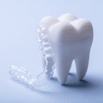 マウスピース矯正のイメージ